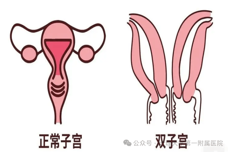 双子宫来例假特点图片