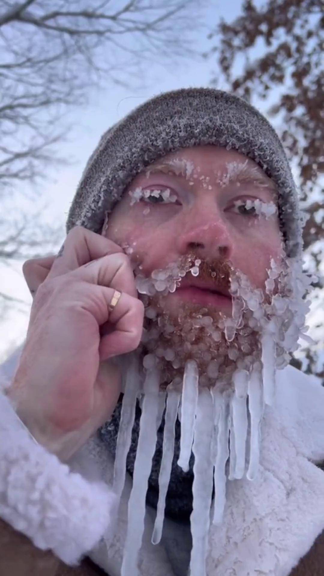 太酷了吧,怎么做到脸上结满厚厚的冰块的 结冰 冬季 玩冰