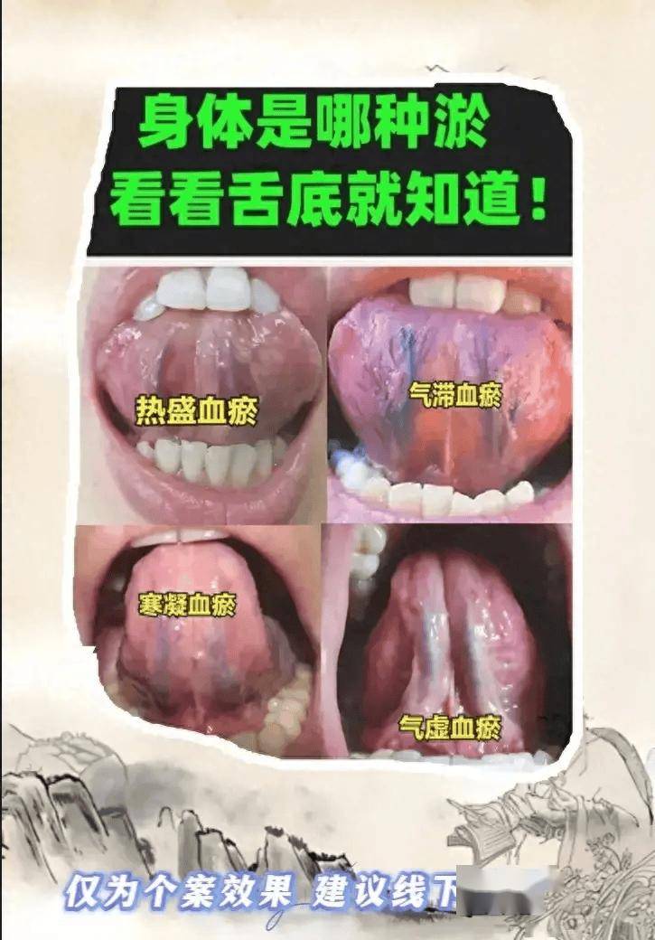 舌头构造图底部图片