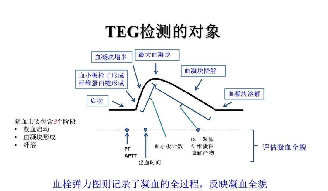 孕妇血栓弹力图ci值高图片