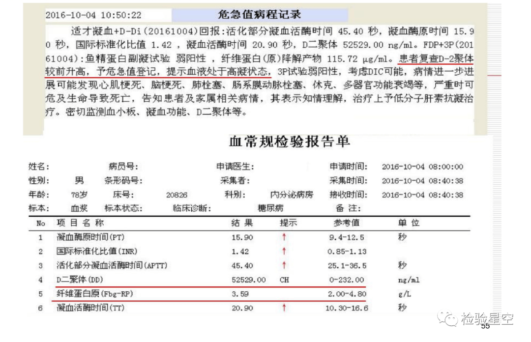 血栓弹力图检验报告图片