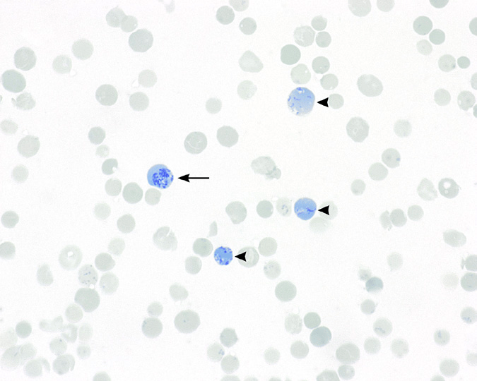 红细胞形态评估:总结正常红细胞,多染性细胞和网织红细胞