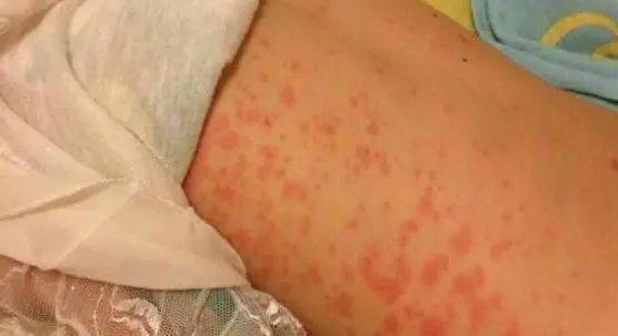 这种水果,越吃血糖越低?3种激活"胰岛素"的食物,你家就有!