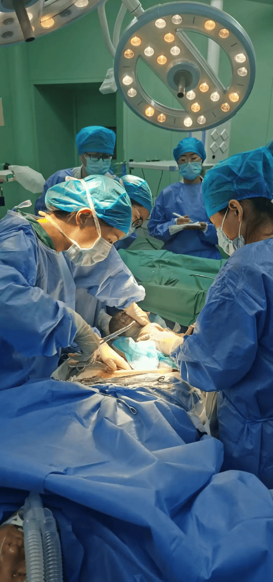 稳!济阳上演生死时速,联手成功抢救大面积胎盘早剥急危重症孕妇