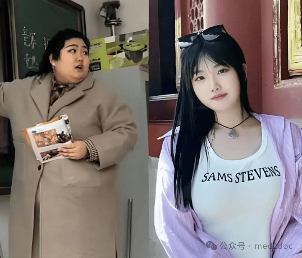 25岁"最肥教师"重160kg,激减75kg!3大瘦身秘诀大公开