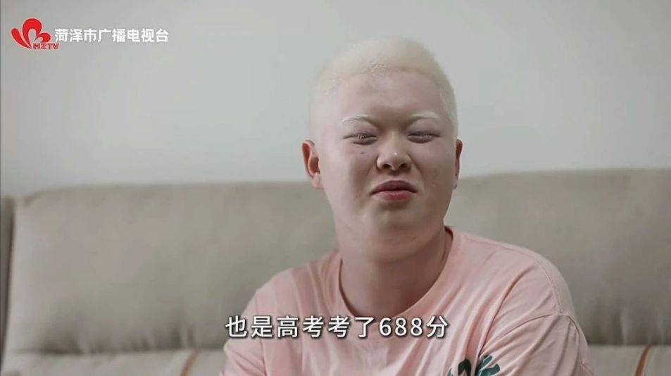 中国青年报记者从清华大学获悉,患有先天性白化病的山东菏泽考生张艺