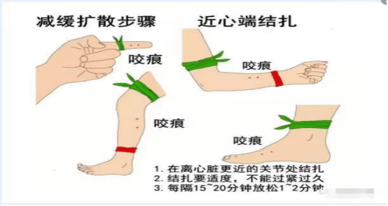 蛇形包扎法适用于图片