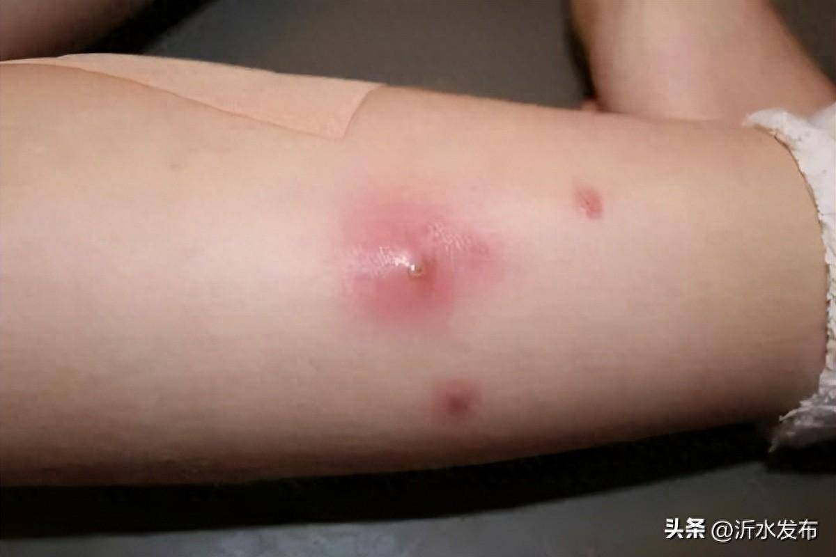 极阴老祖为什么要血玉蜘蛛为什么在线