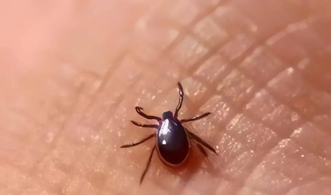 【汤医科普】暑期旅行 别来无"恙"_恙虫_灌木丛_症状