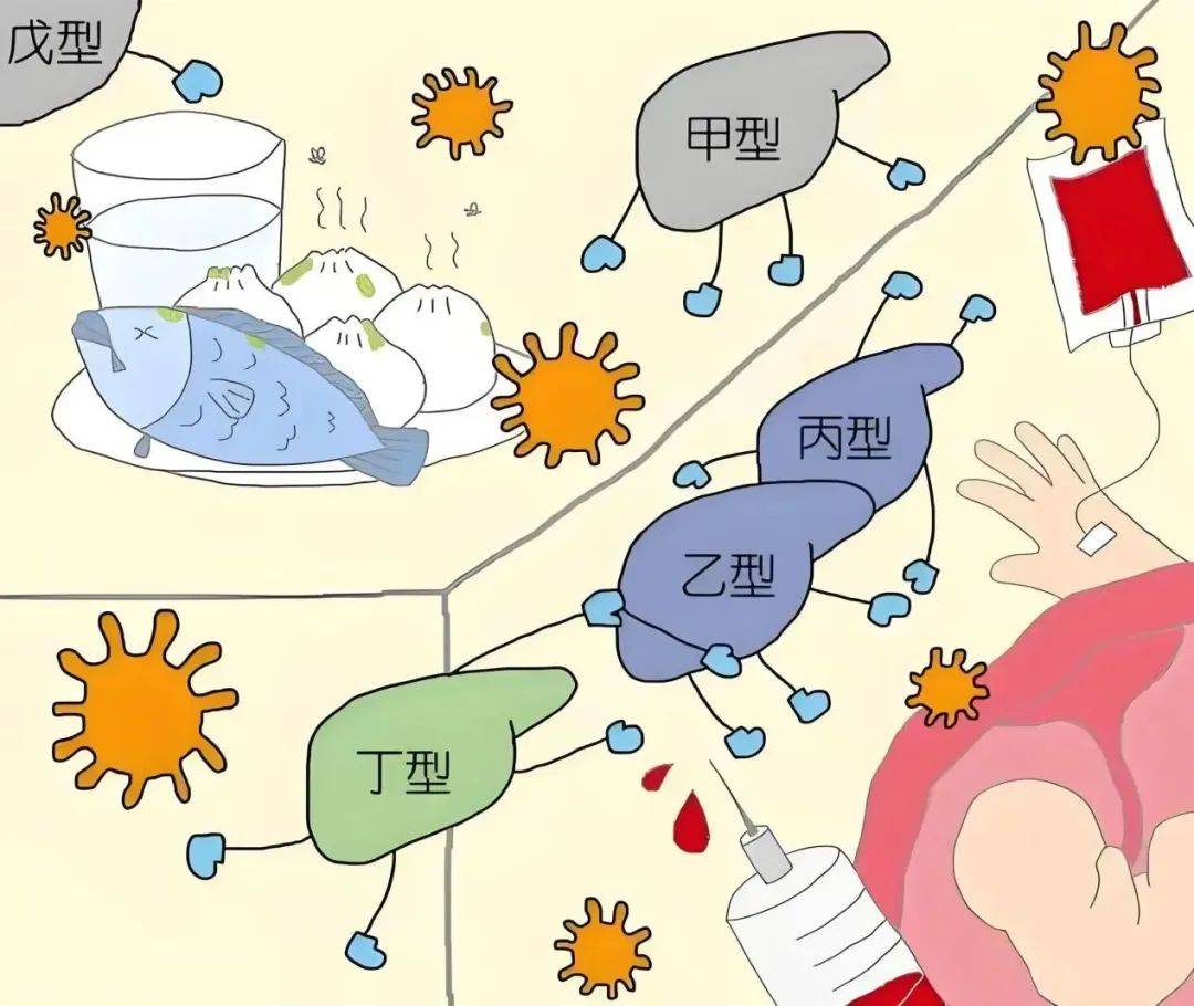 甲型肝炎临床表现图片