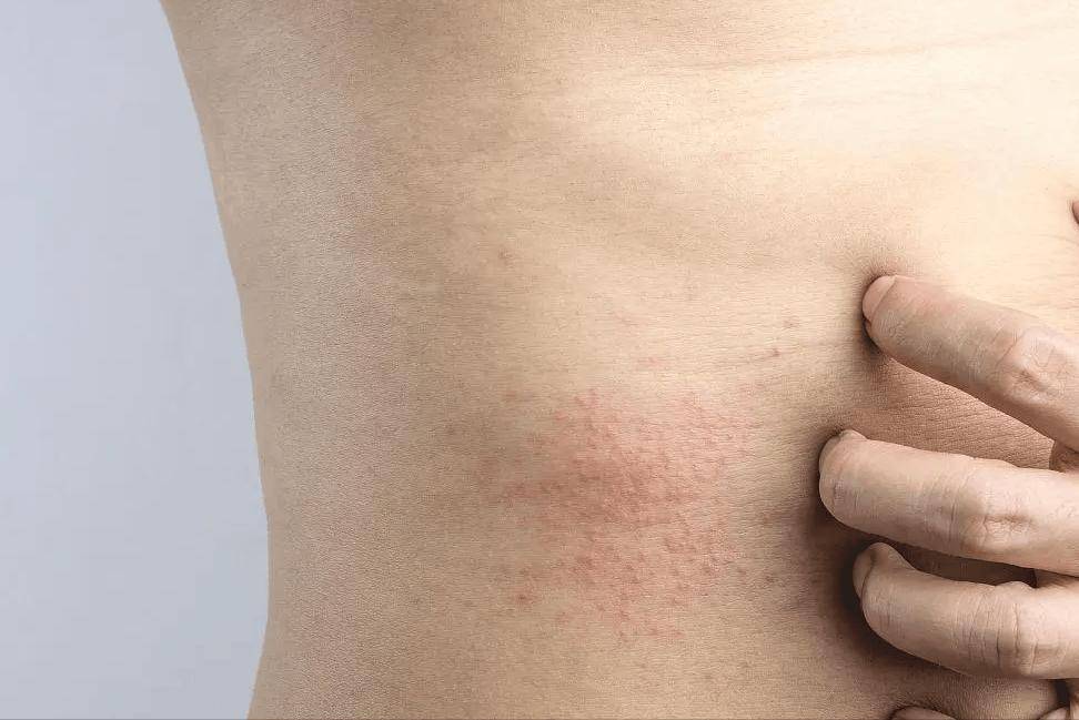 洗澡时若出现这几个异常,或是癌症找上门了,千万要注意早预防!