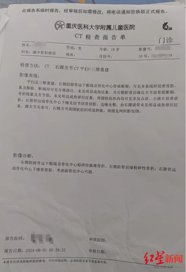 ct检查报告单显示,小陈右侧胫腓骨远干骺端及骨化中心粉碎性骺离骨折