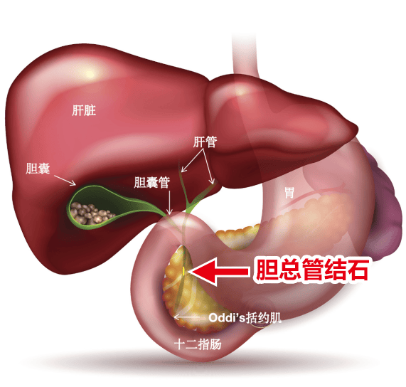 90岁高龄胆管结石患者顺利出院,家属送锦旗致谢钟吾医院普外科团队!