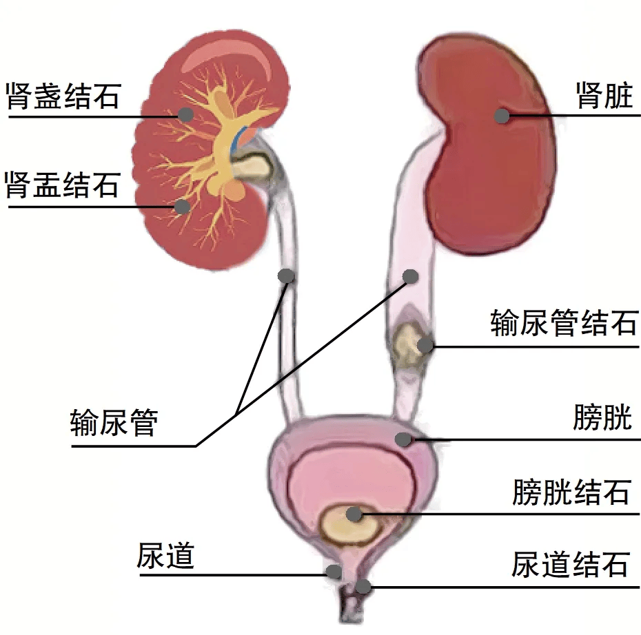 女性输尿管走形图片图片