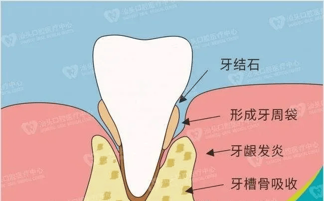 牙床部位图解图片