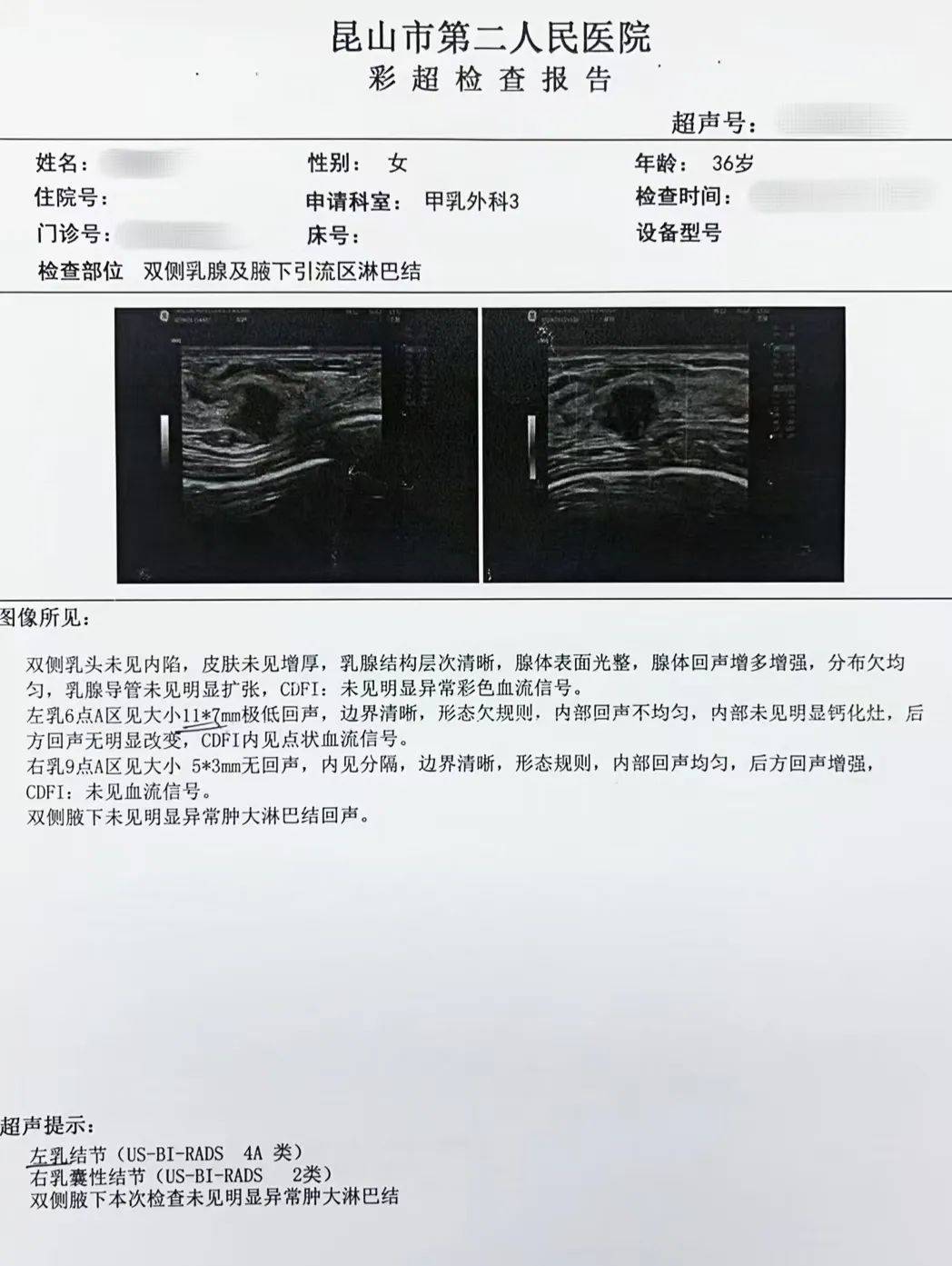 乳腺癌检查报告单图片图片