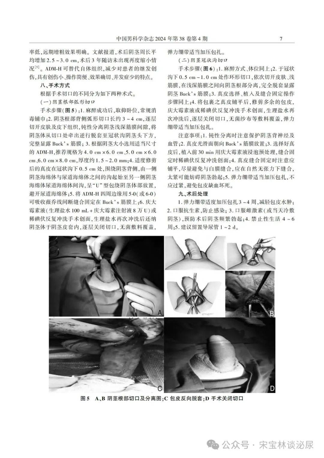 本文出自微信公众号:宋宝林谈泌尿recommended752022版《中国泌尿