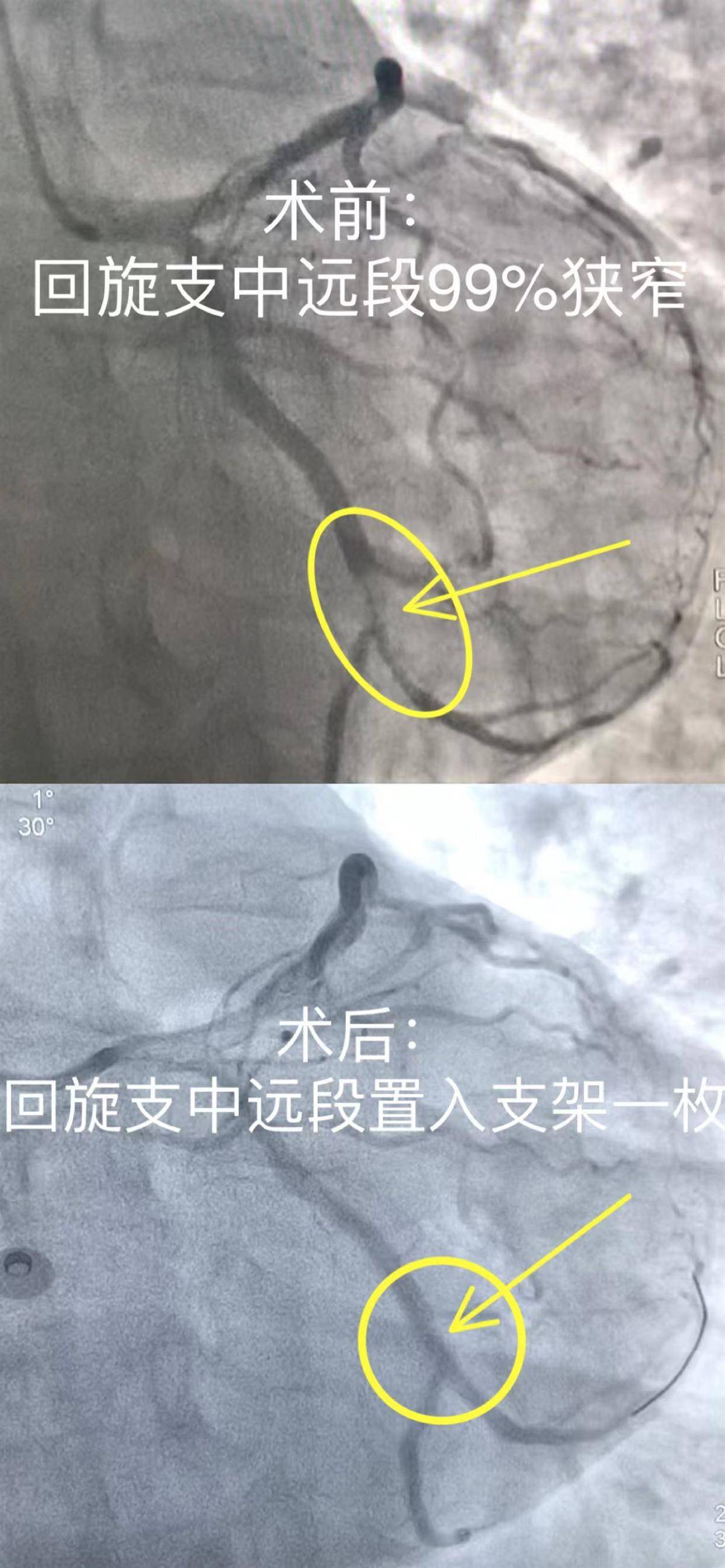 心脏造影图解析图片