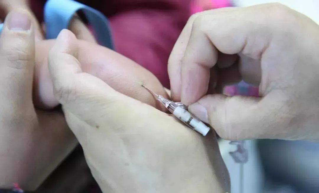 留置针单手送管法,提高成功率,你get了吗?