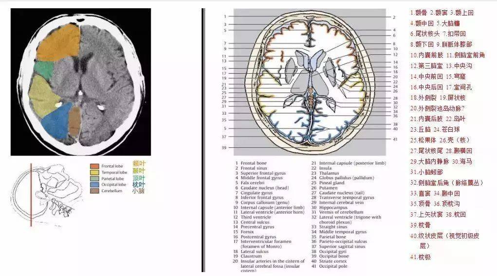 脑部ct结构图片