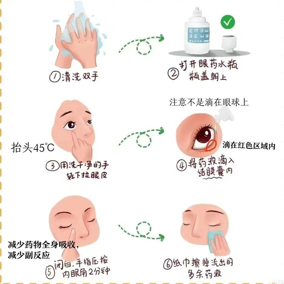 阿托品凝胶小孩用法图图片