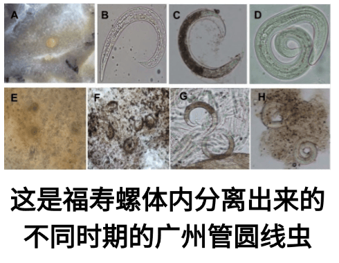 醉螺 寄生虫图片