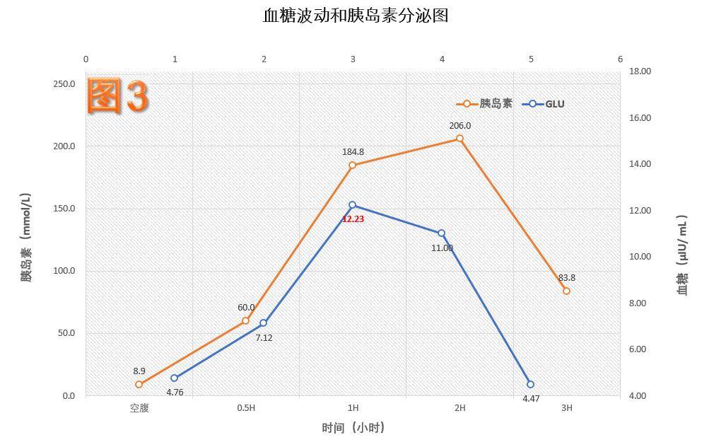 1h,2h血糖偏高;1h,2h,3h小时胰岛素均高国际糖尿病联合会(idf)在