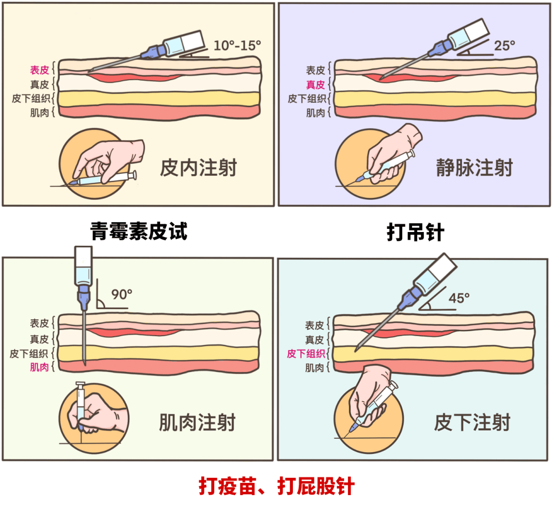 利拉鲁肽腹部注射图图片