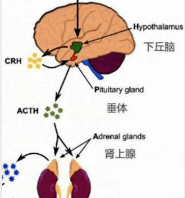 类柯兴综合征图片