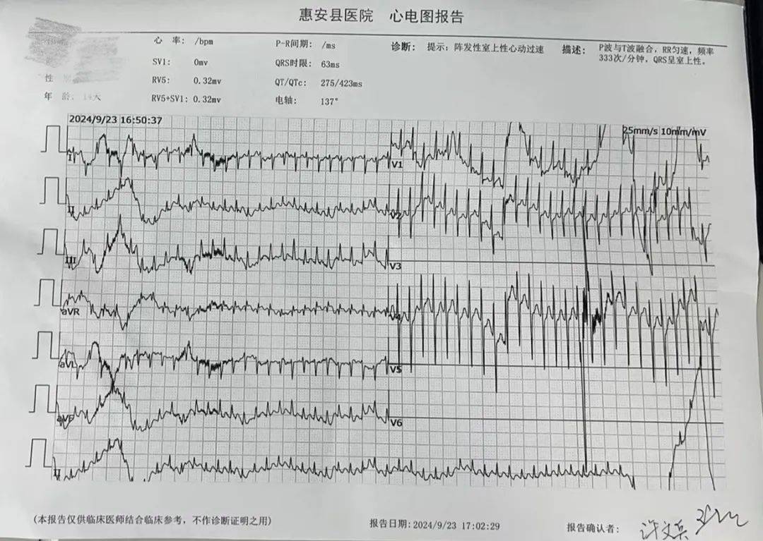 心脏时速图片