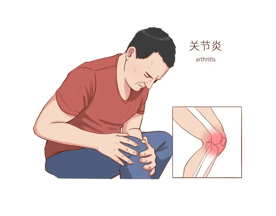 关节疼痛,僵硬不能动?专家提醒或许是因为它