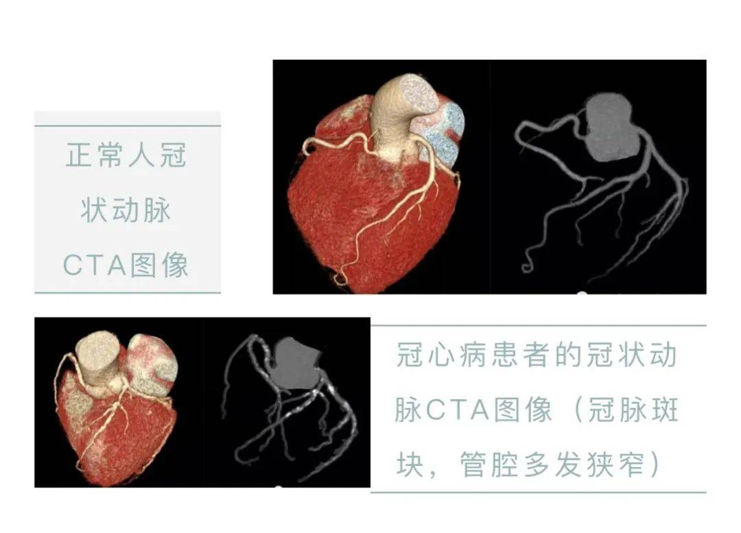 心脏造影图片解说图片图片