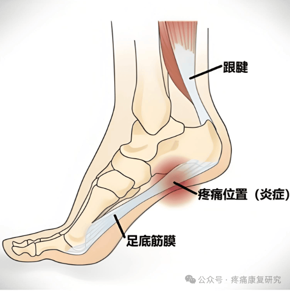 背后可能"隐藏" 5 种疾病_行走_神经_足部