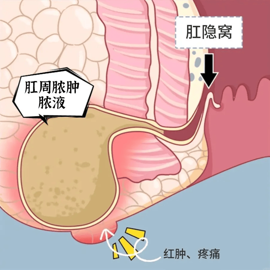 肛瘘医院挂号网(肛瘘医院挂号网站)