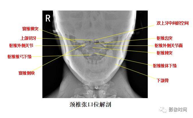 颈椎x解剖图片大全图片