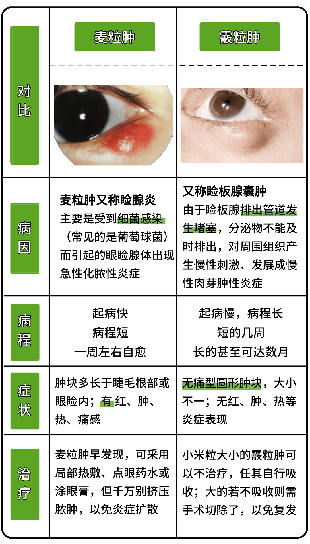 霰粒肿手术后多久恢复图片