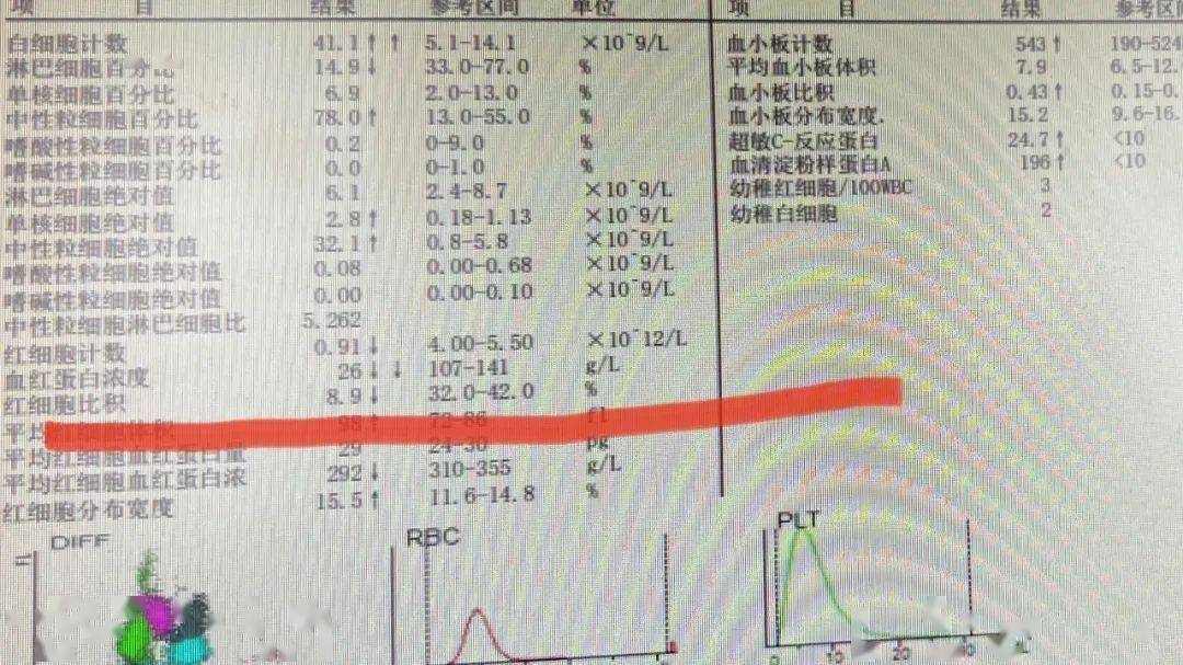 验血报告单图片女孩图片