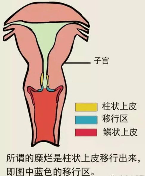 鳞柱交界可见图片