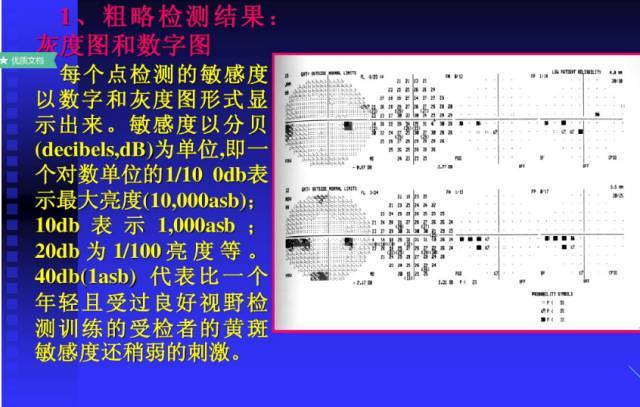 眼科视野检查报告图图片