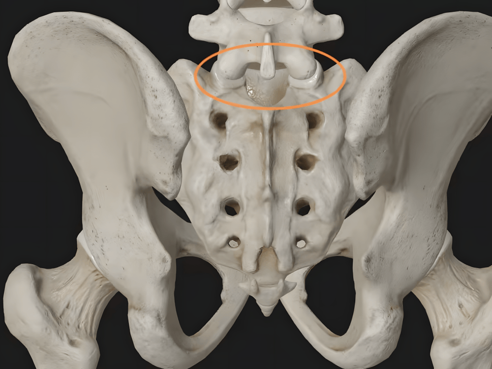 反复腰痛,治疗不见好?提醒:病因可能不在腰上,其实是骶骨错位
