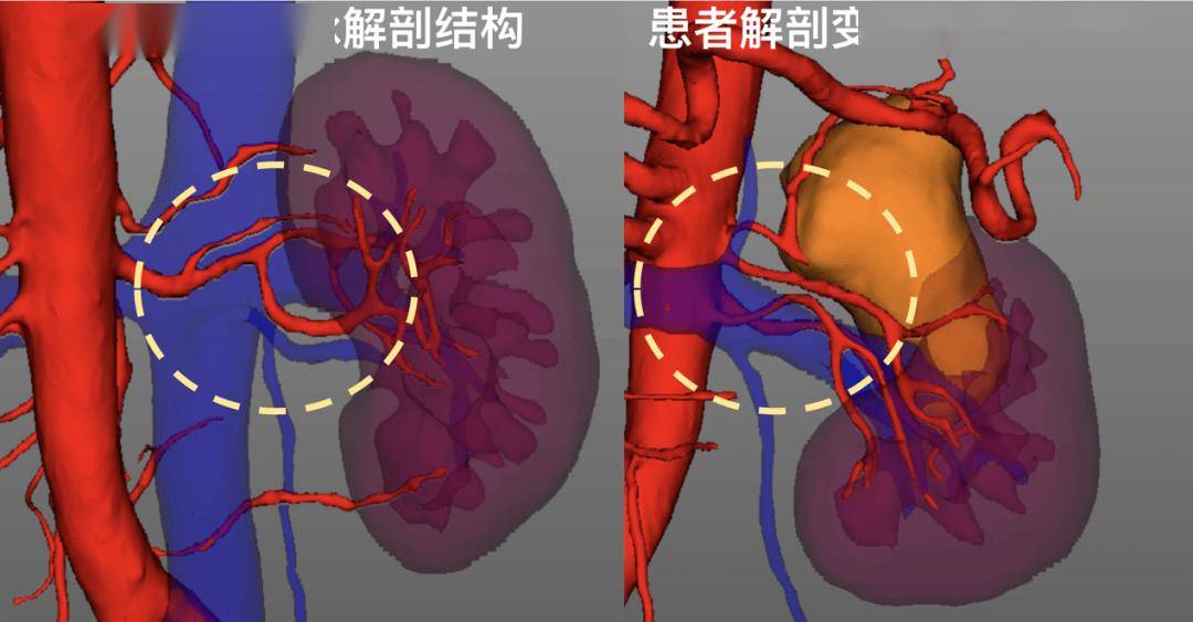 擅長：復雜肝、膽、胰腺腫瘤根治切除，手術切除率高。對肝硬化、脾腫大、頑固性腹水治療及結腸癌...號販子—過來人教你哪里有號!的簡單介紹