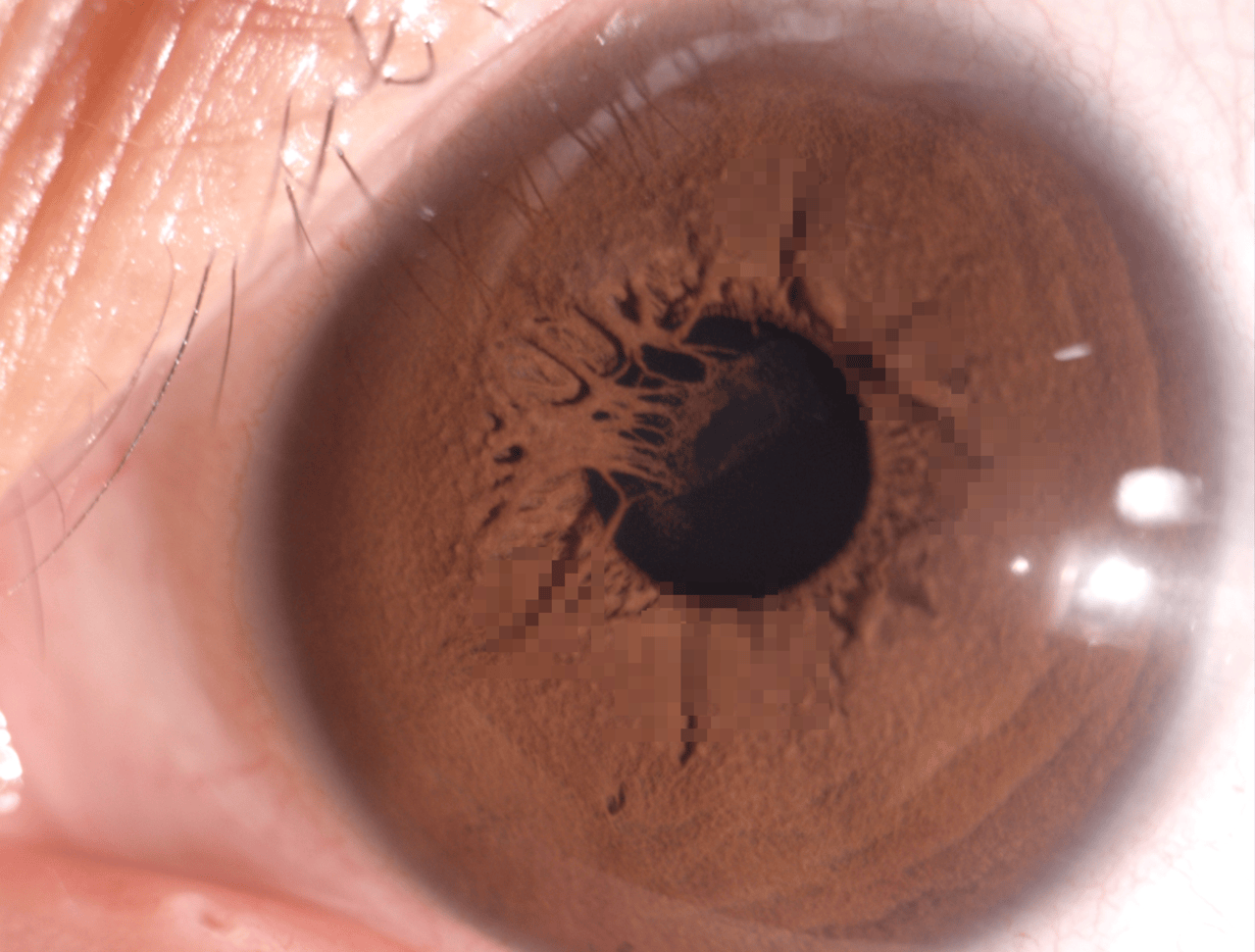 爆火的眼珠子拍照,有网友在体验后竟被发现独特蛛网结构