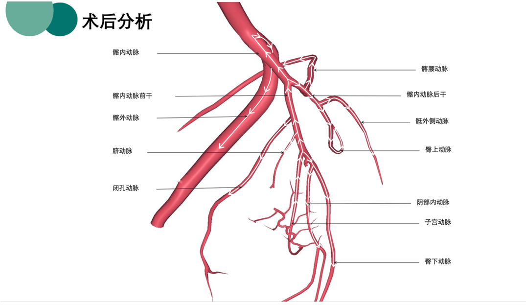 气体栓塞图片