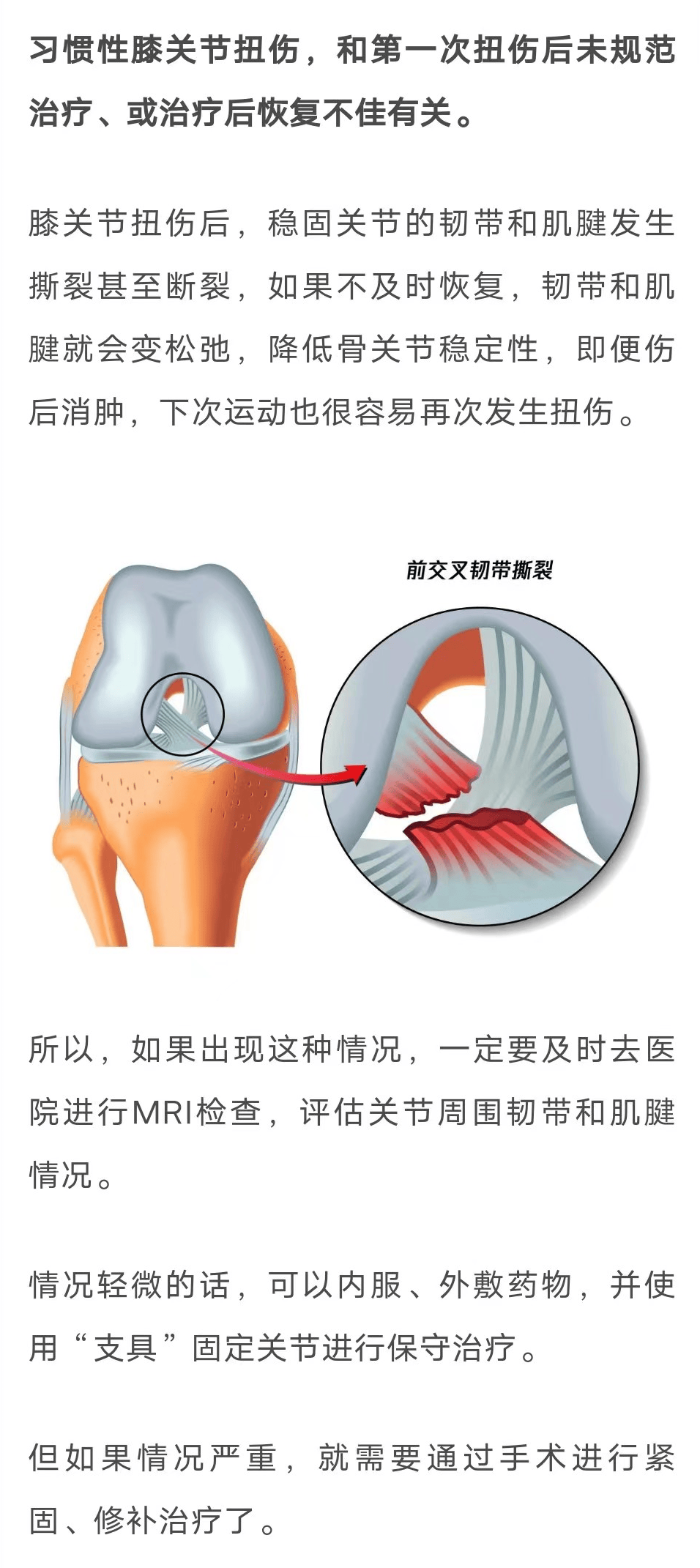 十字韧带疼图片