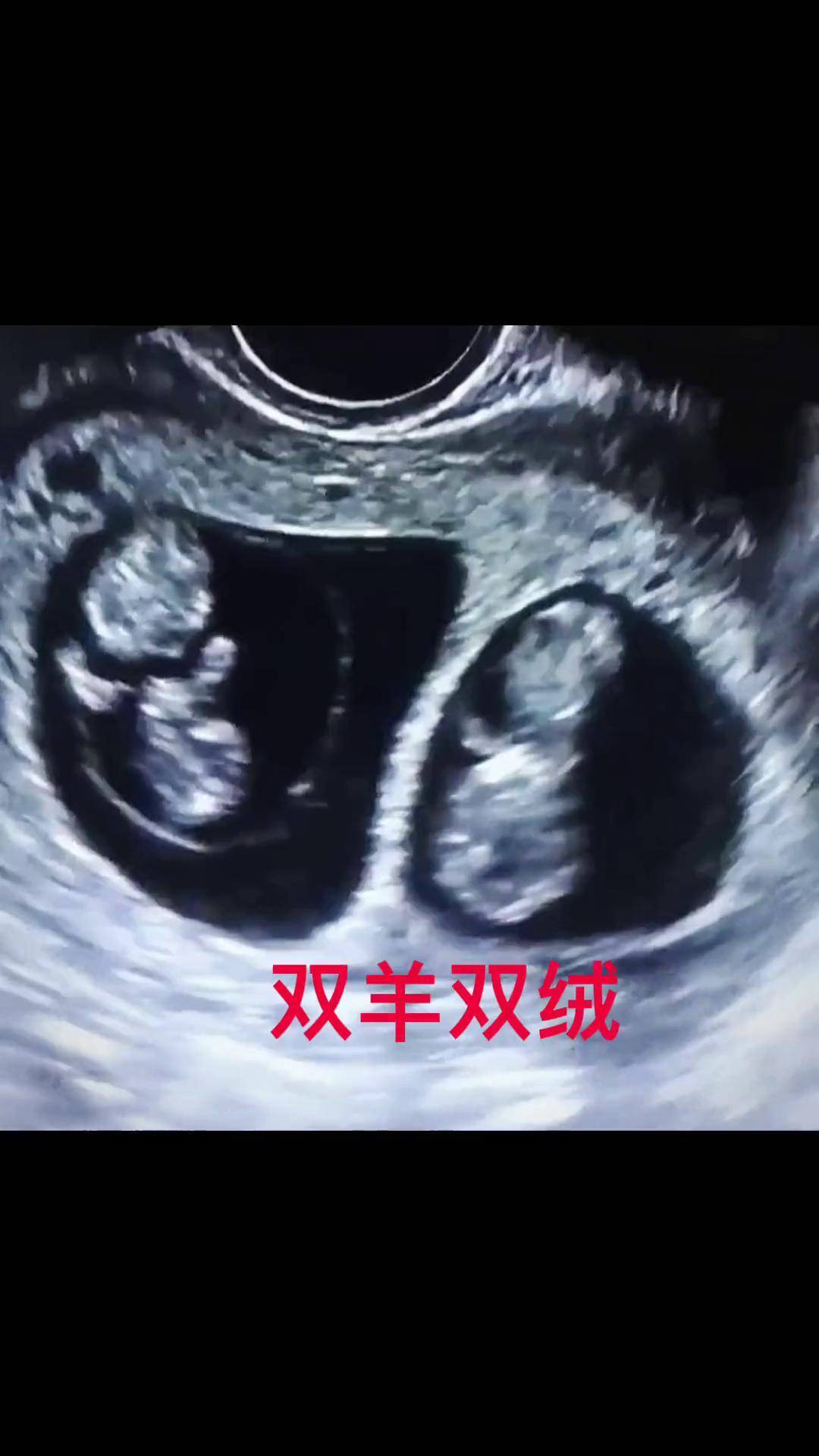创作灵感 双羊双绒双胞胎,两套房,两个人,还是住隔壁愿你们平平安安
