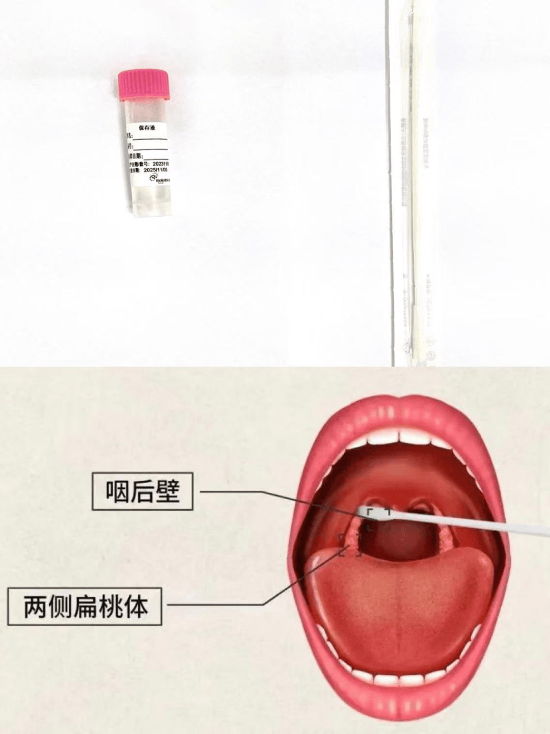 干燥无菌的植绒拭子,轻轻旋转拭子,适度拭抹咽后壁和两侧扁桃体部位