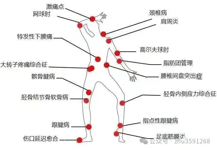 髌前滑囊炎图片