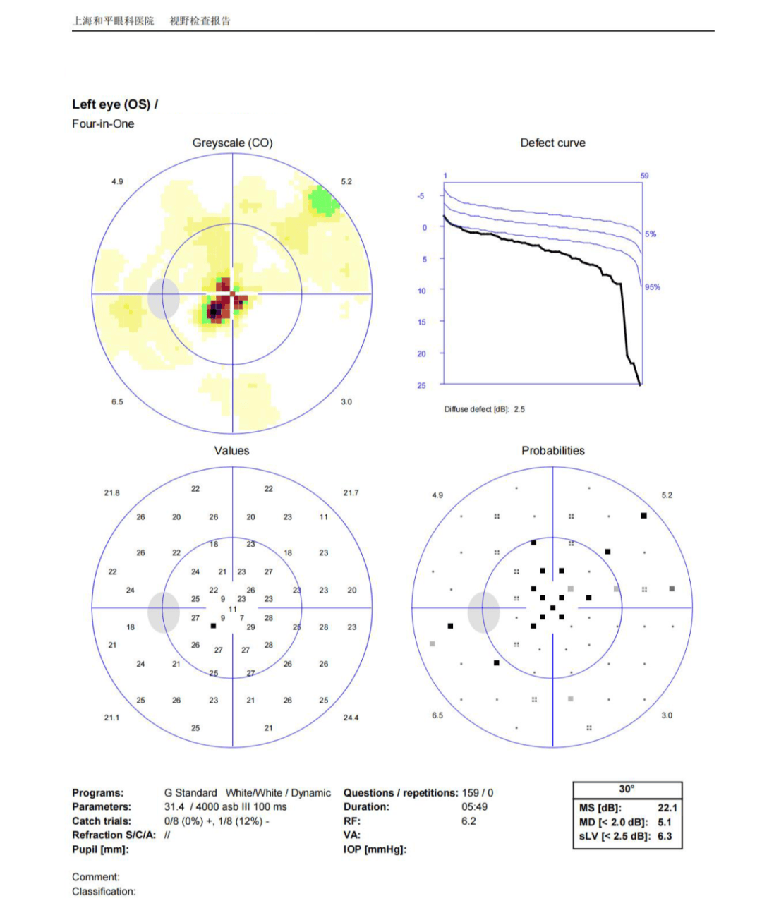 视野右眼这日,我在门诊接待了一位焦急的50岁左右的女士,在丈夫的搀扶