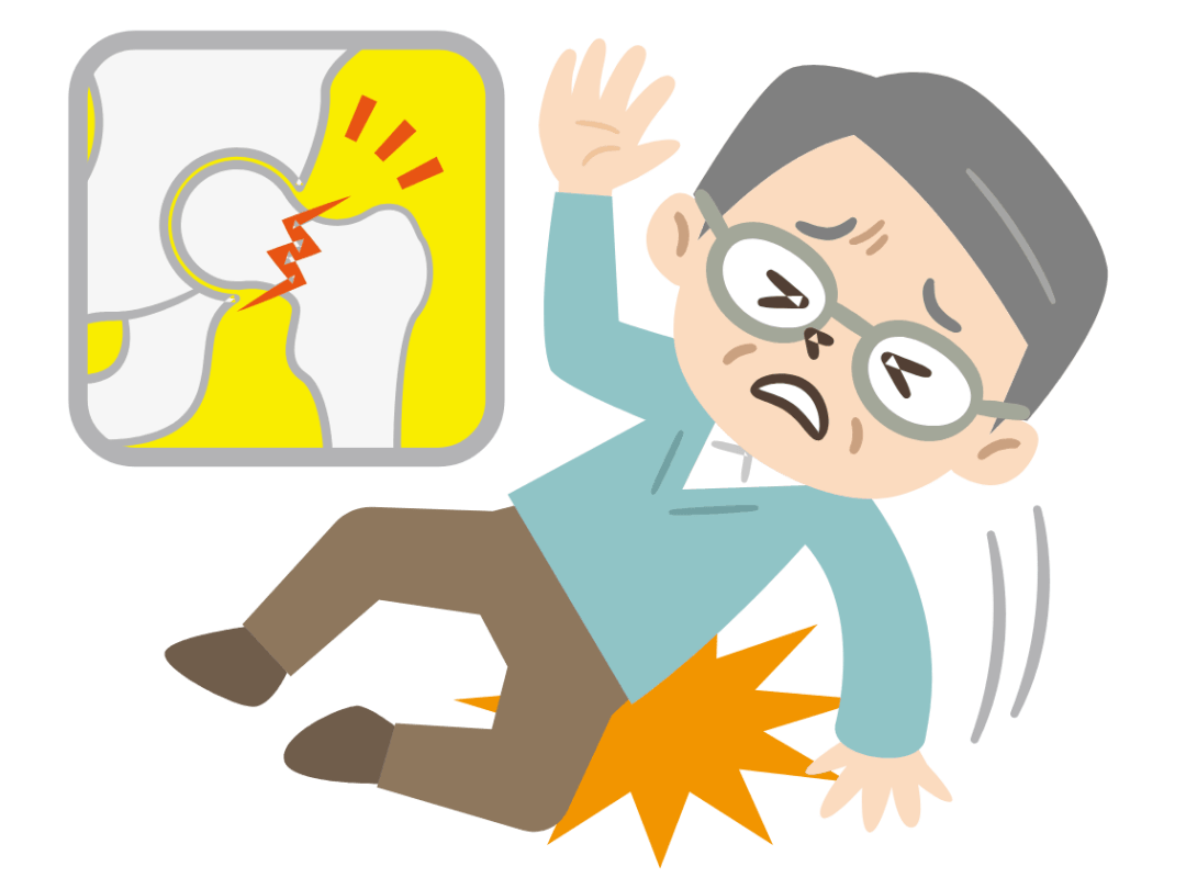 它被称为"人生最后一次骨折",死亡率高到难以想象!