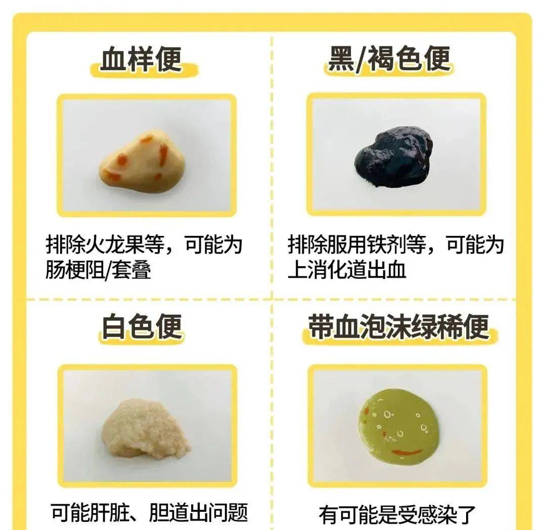 大便为什么是臭的而不是香的为什么在线